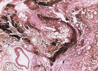 Гистологическая картина поджелудочной железы